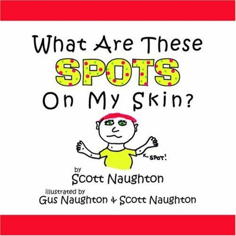 What Are These Spots On My Skin? [Paperback] Naughton, Scott